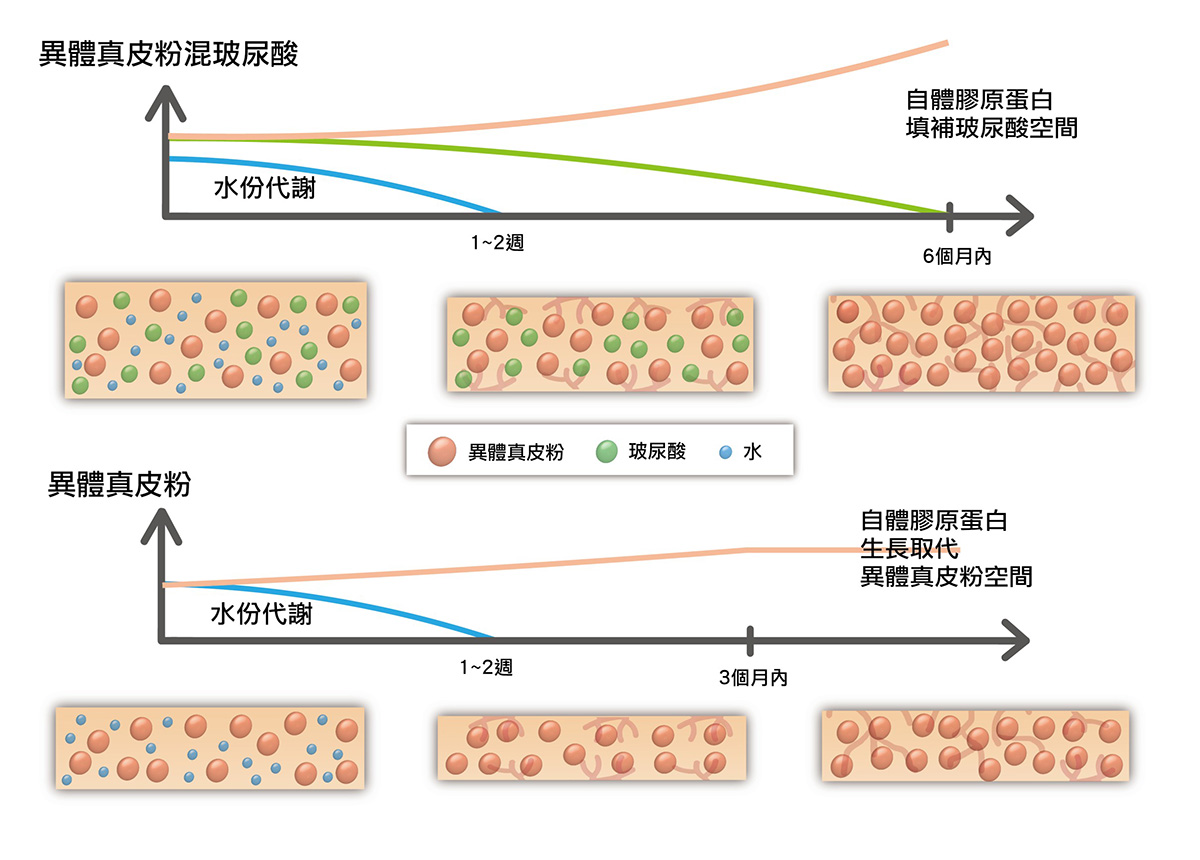 異體真皮粉MegaFill @己研美學診所