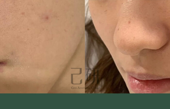 自信見證 @己研美學診所