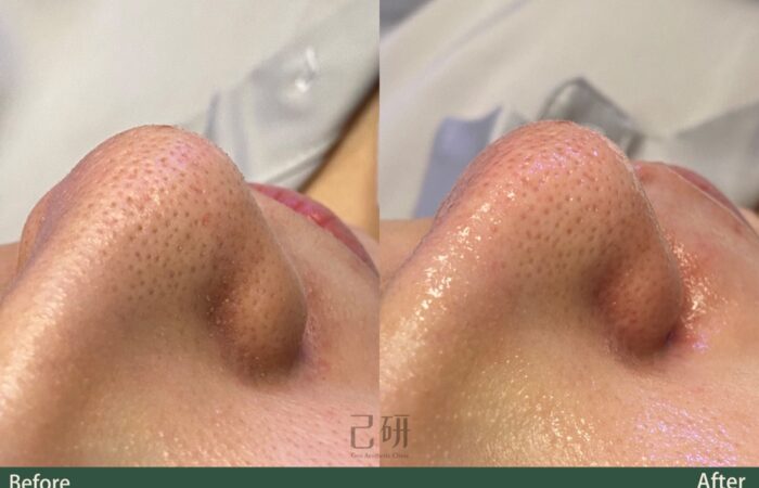 自信見證 @己研美學診所