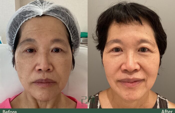 自信見證 @己研美學診所