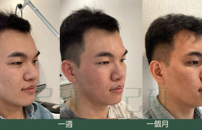 自信見證 @己研美學診所