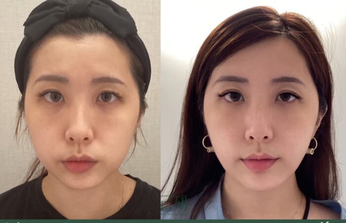 自信見證 @己研美學診所