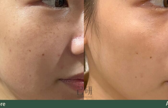 自信見證 @己研美學診所