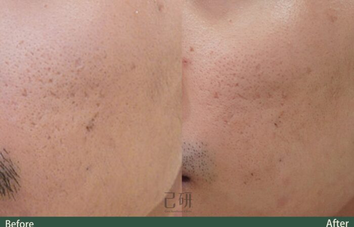 自信見證 @己研美學診所