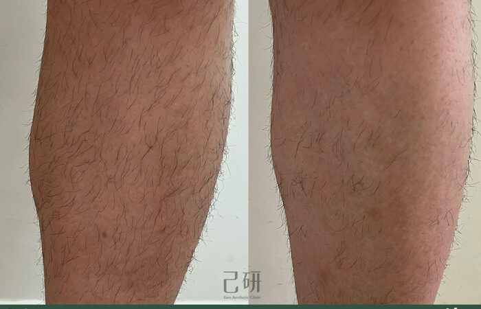 自信見證 @己研美學診所