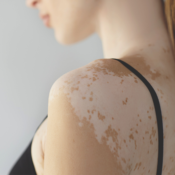 皮膚專科_診所介紹 @己研美學診所