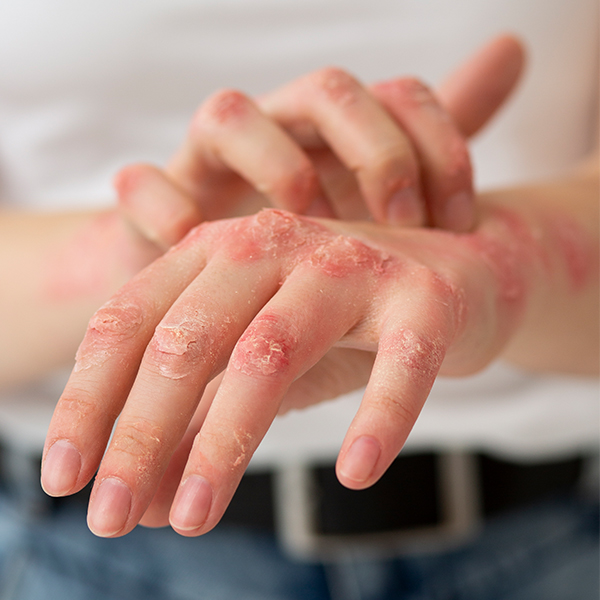 皮膚專科_診所介紹 @己研美學診所