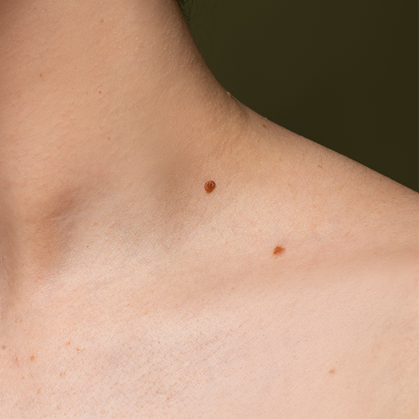 皮膚專科_診所介紹 @己研美學診所