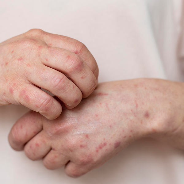 皮膚專科_診所介紹 @己研美學診所