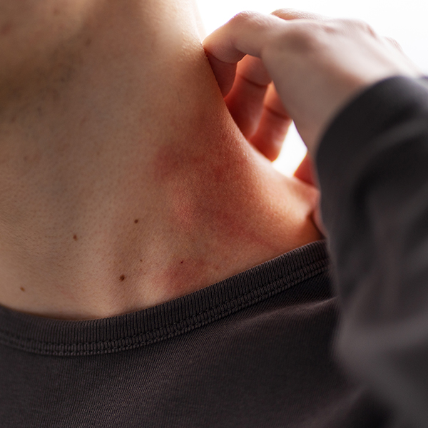 皮膚專科_診所介紹 @己研美學診所